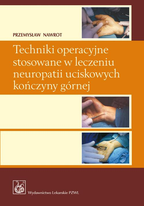 Okładka: Techniki operacyjne stosowane w leczeniu neuropatii uciskowych kończyn