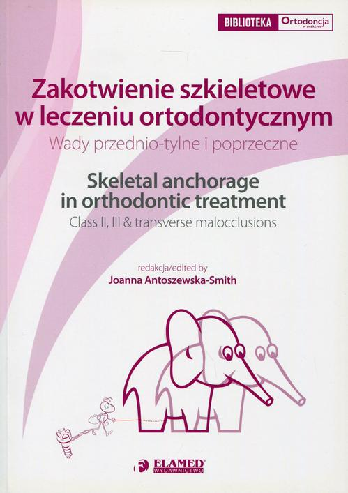 Okładka: Zakotwienie szkieletowe w leczeniu ortodontycznym